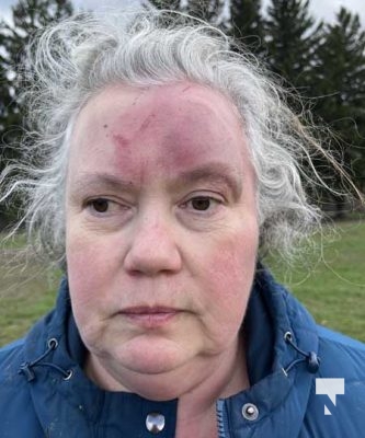 Woman Struck Cobourg Dog Park April 22, 2024 2204